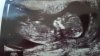 20160411_145847.jpg