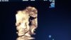 IMG-20160420-WA0000.jpg