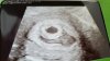 20160428_175529.jpg
