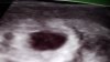 20160428_212824.jpg