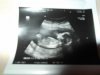 echo 17-09-2012 004.jpg