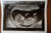 buikfoto en echo 12,2w 007.jpg