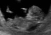 baby2nub.jpg