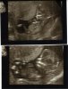echo foto's baby.jpg