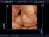 BABY-_VISSER_20120924_RT-_3D-_2-_-R_0014.jpg