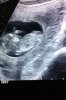 echo 25-09 004.jpg