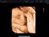BABYVIEW_0014.jpg