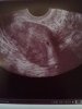 echo_27sept_2.jpg