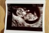 2016-05-03 19.41.48.jpg