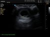 J162138_401664_Echo[1].jpg