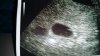 20160518_173701.jpg