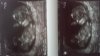 20160523_162446.jpg