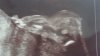 20160525_152955.jpg