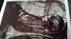 20160524_152941.jpg