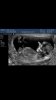 Screenshot_2016-05-17-10-13-02.jpg