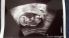 20160609_144831.jpg