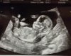Baby.jpg