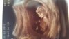 20160620_171016.jpg