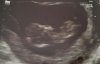 20160701_092426.jpg