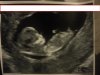 baby6.jpg
