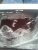 babynub2.jpg