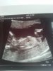 babynub1.jpg