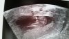 20160727_141812.jpg