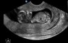 baby3.jpg
