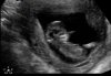 baby4.jpg