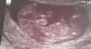 CYMERA_20160731_095838.jpg