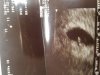 20160817_100825.jpg