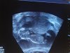 20160819_145730.jpg