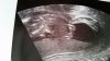 20160727_141821.jpg