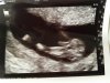 echo 12w 5d.jpg