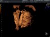 BABYBOND_6.jpg