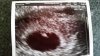 20160112_103914.jpg