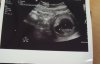 20160920_181450.jpg