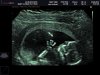 BABY ULFMAN_0003.jpg