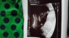 20160926_174957.jpg