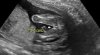 BABY-GIRL_2.jpg