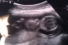 IMAG0283 26-09-2012 13,5wk.jpg