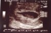 echo 2-10-2012.jpg
