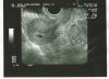 echo 04-10-2012.jpg