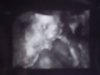 4D echo 04-10-2012.jpg