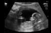 baby.jpg