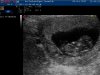 2012-10-09T12#43#11-09.jpg