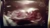 IMG-20161019-WA0000.jpg