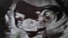 IMG_20161105 echo.jpg