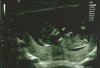 20161105_115445.jpg