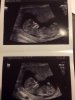 12 wk 2 dg.jpg